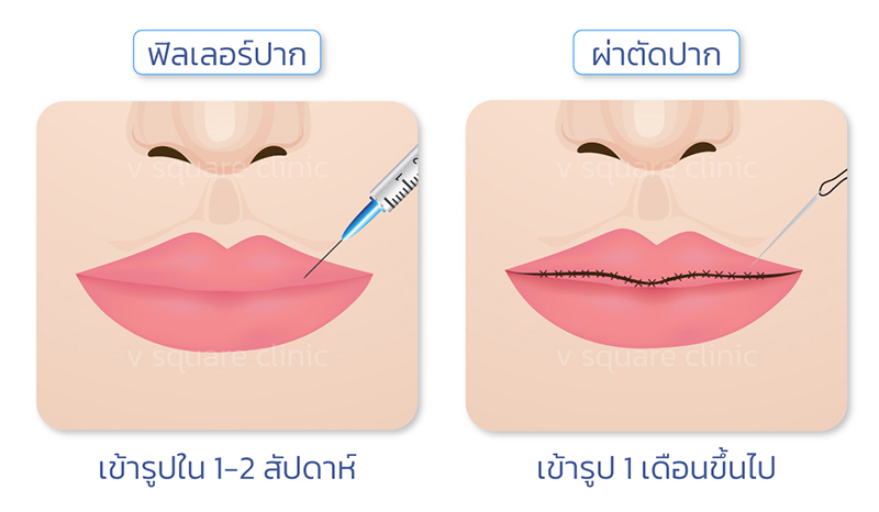 ทำปากกระจับมีวิธีไหนบ้าง